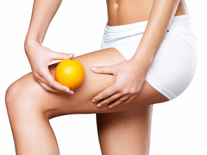 TIPS TO PREVENT CELLULITE